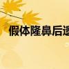 假體隆鼻后遺癥的危害（假體隆鼻后遺癥）
