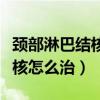頸部淋巴結(jié)核怎么治療效果最好（頸部淋巴結(jié)核怎么治）