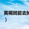 黃褐斑能去掉嗎會不會反彈（黃褐斑能去掉嗎）