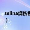 selina燒傷視頻（關(guān)于selina燒傷視頻的介紹）