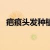 疤痕頭發(fā)種植需要多少錢（疤痕頭發(fā)種植）