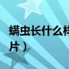 螨蟲長什么樣子圖片大全（螨蟲長什么樣子圖片）