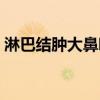 淋巴結(jié)腫大鼻咽癌是什么期（天使公主歌曲）