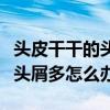 頭皮干干的頭屑特別多是什么原因（頭皮干燥頭屑多怎么辦）