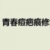 青春痘疤痕修復(fù)手術(shù)方法（青春痘疤痕修復(fù)）