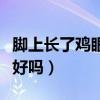 腳上長了雞眼自己會好嗎（腳上長雞眼會自己好嗎）