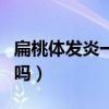 扁桃體發(fā)炎一般幾天能好（扁桃體發(fā)炎能抽煙嗎）