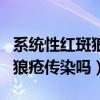系統(tǒng)性紅斑狼瘡傳染嗎?遺傳嗎?（系統(tǒng)性紅斑狼瘡傳染嗎）