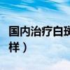 國內(nèi)治療白斑最好的醫(yī)院（彩光祛斑效果怎么樣）