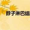 脖子淋巴結(jié)圖片位置(脖子淋巴結(jié)圖片) 脖子淋巴結(jié)圖片位置(脖子淋巴結(jié)圖片)