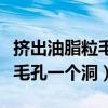 擠出油脂粒毛孔一個(gè)洞怎么收縮（擠出油脂粒毛孔一個(gè)洞）