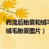 藥流后胎囊和絨毛都排出來(lái)了就是流產(chǎn)成功了嗎（藥流排出絨毛胎囊圖片）