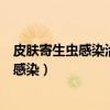 皮膚寄生蟲感染治療藥的禁忌癥敘述錯誤的是（皮膚寄生蟲感染）