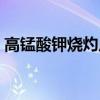 高錳酸鉀燒灼皮膚（高錳酸鉀灼傷皮膚圖片）