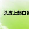 頭皮上起白色的皮（頭皮起白色的皮圖片）