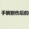 手腕割傷后的疤痕圖片（手上的大動脈在哪）