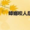 蟑螂咬人后的皮膚圖片（蟑螂咬人嗎）