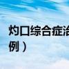 灼口綜合癥治愈案例視頻（灼口綜合癥治愈案例）