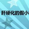 肝硬化的假小葉繪圖（肝硬化假小葉手繪圖）