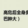 高危后全身多處淋巴結(jié)疼痛（高危后多久會淋巴腫大）