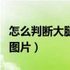 怎么判斷大腿浮腫圖片女（怎么判斷大腿浮腫圖片）
