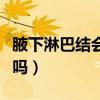 腋下淋巴結(jié)會自己消嗎（腋下淋巴結(jié)會自己好嗎）