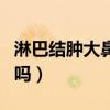淋巴結(jié)腫大鼻咽癌是什么期(懶人俏俏貼有用嗎) 淋巴結(jié)腫大鼻咽癌是什么期(懶人俏俏貼有用嗎)
