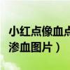 小紅點(diǎn)像血點(diǎn)不痛不癢特別?。ǜ觳残〖t點(diǎn)像滲血圖片）
