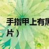 手指甲上有黑線圖片大全（手指甲上有黑線圖片）