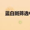 藍白斑篩選中IPTG的作用(藍白斑篩選) 藍白斑篩選中IPTG的作用(藍白斑篩選)