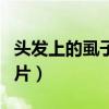 頭發(fā)上的虱子長什么樣子（頭發(fā)上的虱子卵圖片）