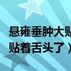 懸雍垂腫大貼著舌頭了怎么治療（懸雍垂腫大貼著舌頭了）
