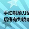 手動(dòng)剃須刀刮完胡子后疼有灼燒感（刮完胡子后疼有灼燒感）
