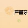 嚴(yán)重牙周炎圖片(牙周炎圖片) 嚴(yán)重牙周炎圖片(牙周炎圖片)