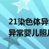 21染色體異常是傻子的幾率多大（21染色體異常嬰兒照片）