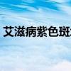 艾滋病紫色斑塊圖片（艾滋病紫色斑點(diǎn)圖片）