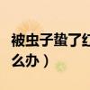 被蟲子蟄了紅腫癢怎么辦（被蟲子蟄了刺痛怎么辦）