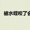 被水蛭咬了會有事嗎(被水蛭咬了怎么辦) 被水蛭咬了會有事嗎(被水蛭咬了怎么辦)