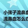 小孩子流鼻血怎么辦最簡(jiǎn)單方法止血（小孩子流鼻血怎么辦）