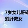 7歲女兒肝硬化 90后爸爸只吃黃瓜暴瘦30斤割肝救女