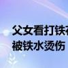 父女看打鐵花表演被燙傷 現(xiàn)場(chǎng)還有多人表示被鐵水燙傷