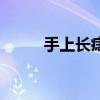 手上長(zhǎng)痣會(huì)不會(huì)癌變（手上長(zhǎng)痣）