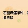 右腿疼痛浮腫，男子確診靜脈血栓！醫(yī)生提醒：揉腿、拍打很危險