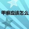 甲癬應(yīng)該怎么治療方法（甲癬最佳治療方法）