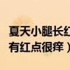 夏天小腿長(zhǎng)紅點(diǎn)點(diǎn)很癢怎么回事（夏天小腿上有紅點(diǎn)很癢）
