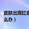 皮膚出現(xiàn)紅血絲怎么修復(fù)（皮膚出現(xiàn)紅血絲怎么辦）